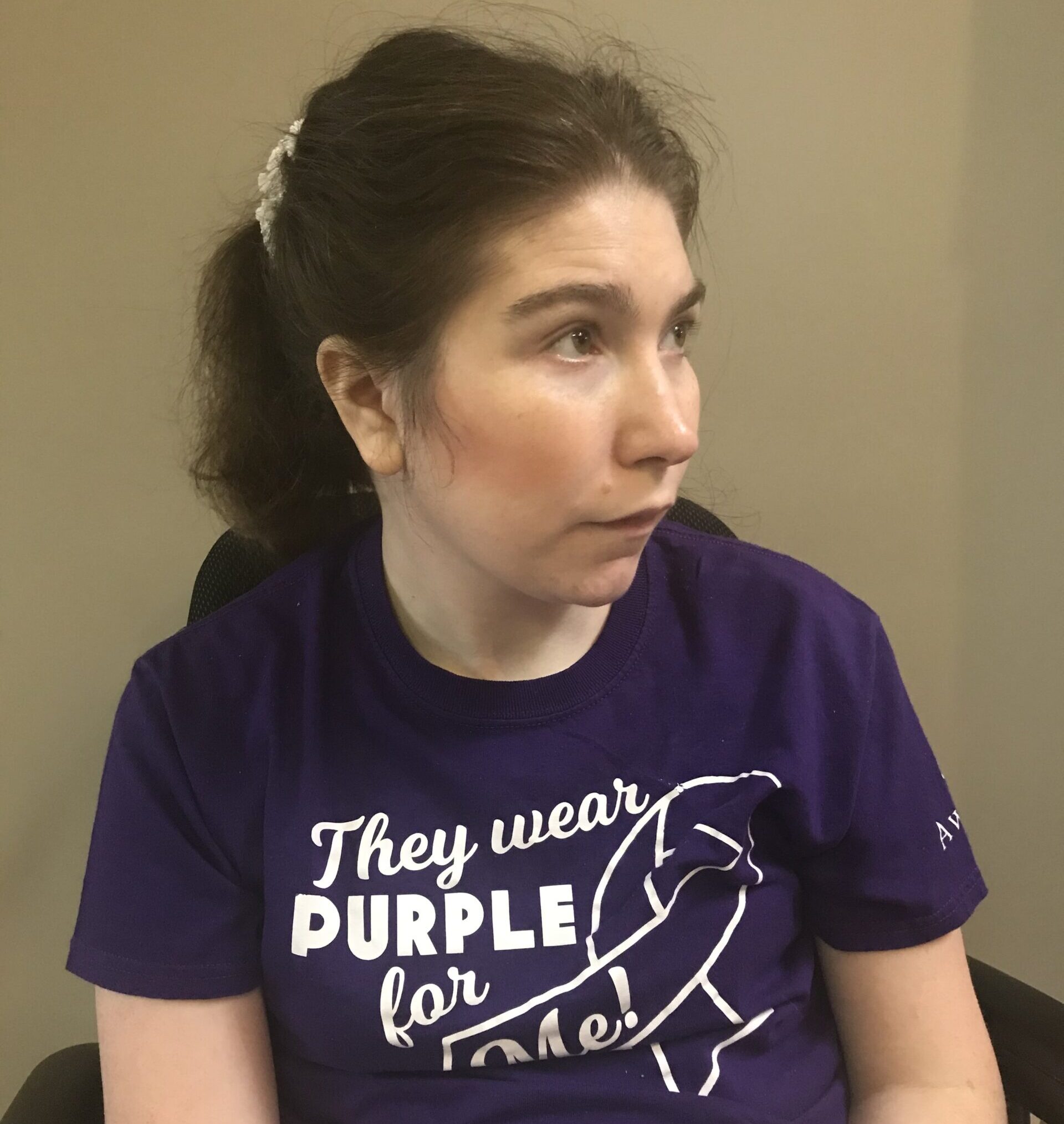 woman with sanfilippo syndrome