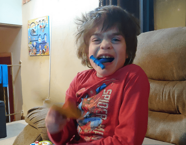 Boy with sanfilippo syndrome on a sofa