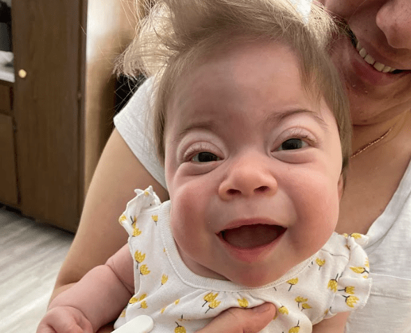 Smiling baby with ML syndrome